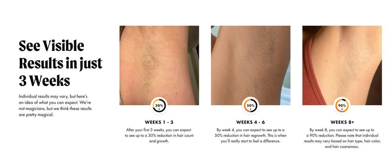 SmoothSkin 3-in-1 IPL Laser Hair Removal – Painless, Permanent Hair Reduction for All Skin Types